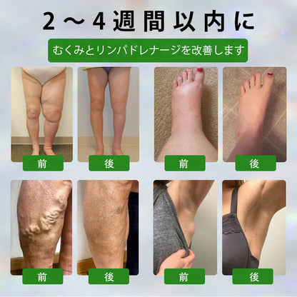 🔥Laleia® 黒クミンむくみ緩和ハーブクリーム