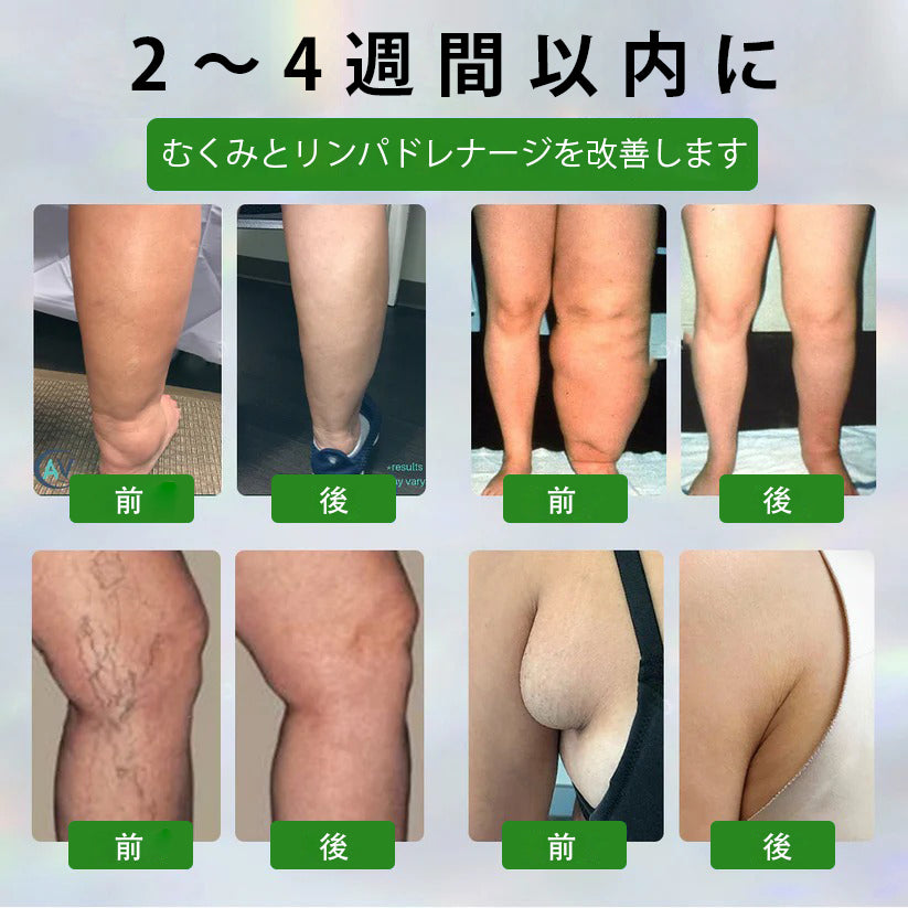 🔥Laleia® 黒クミンむくみ緩和ハーブクリーム