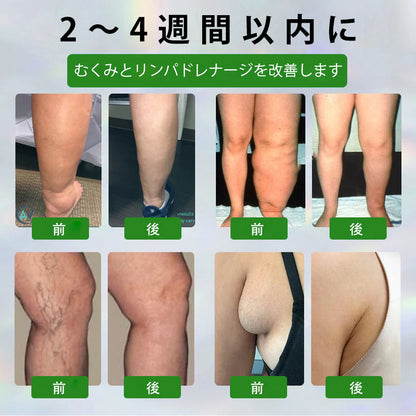 🔥Laleia® 黒クミンむくみ緩和ハーブクリーム