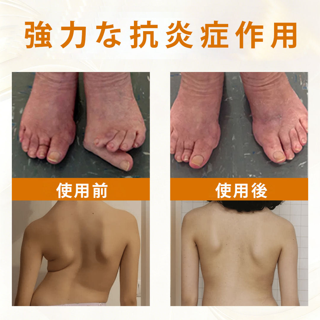 Laleia® ScorpiTakt 関節・筋肉ケア軟膏