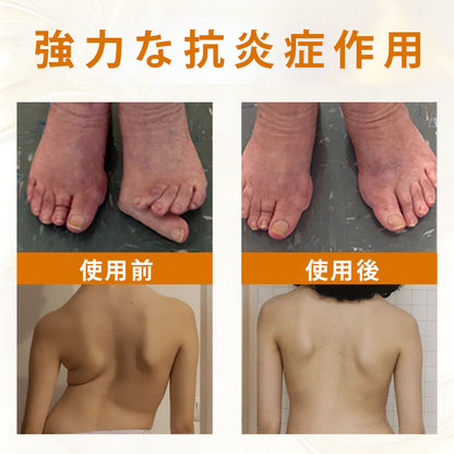 Laleia® ScorpiTakt 関節・筋肉ケア軟膏