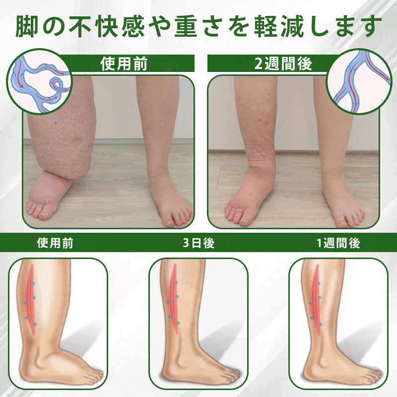 🔥Laleia® 黒クミンむくみ緩和ハーブクリーム