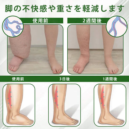 🔥Laleia® 黒クミンむくみ緩和ハーブクリーム