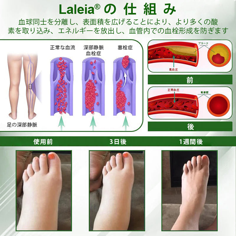 🔥Laleia® 黒クミンむくみ緩和ハーブクリーム