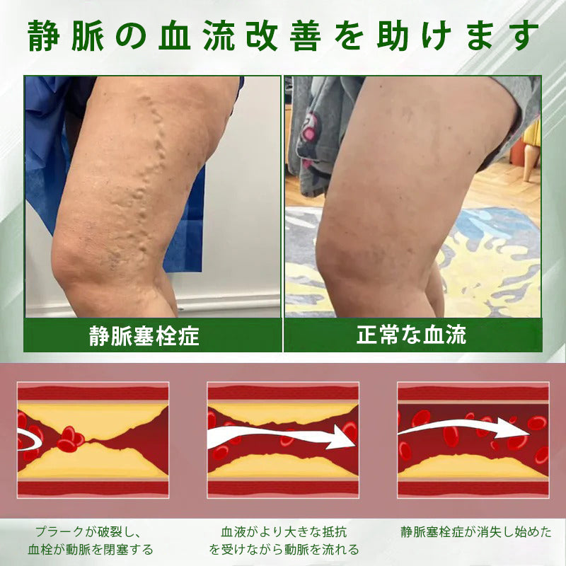 🔥Laleia® 黒クミンむくみ緩和ハーブクリーム