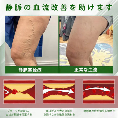 🔥Laleia® 黒クミンむくみ緩和ハーブクリーム